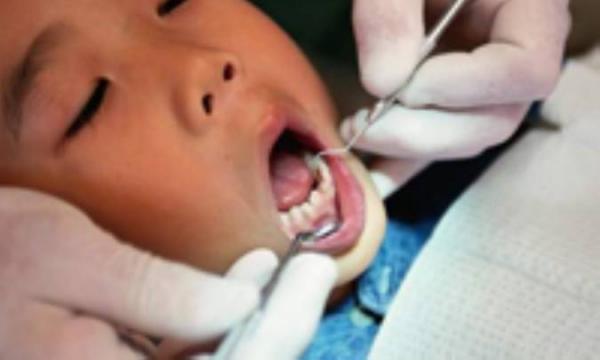 مراقبت های بعد از دندانپزشکی