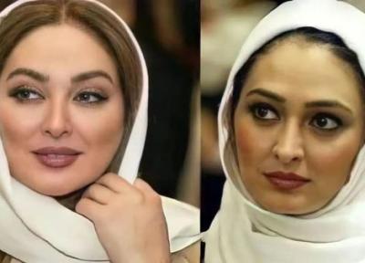 عکس قبل و بعد عمل زیبایی بازیگران زن ایرانی ، چقدر تغییر !